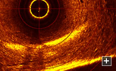 Sonar data of a dam area